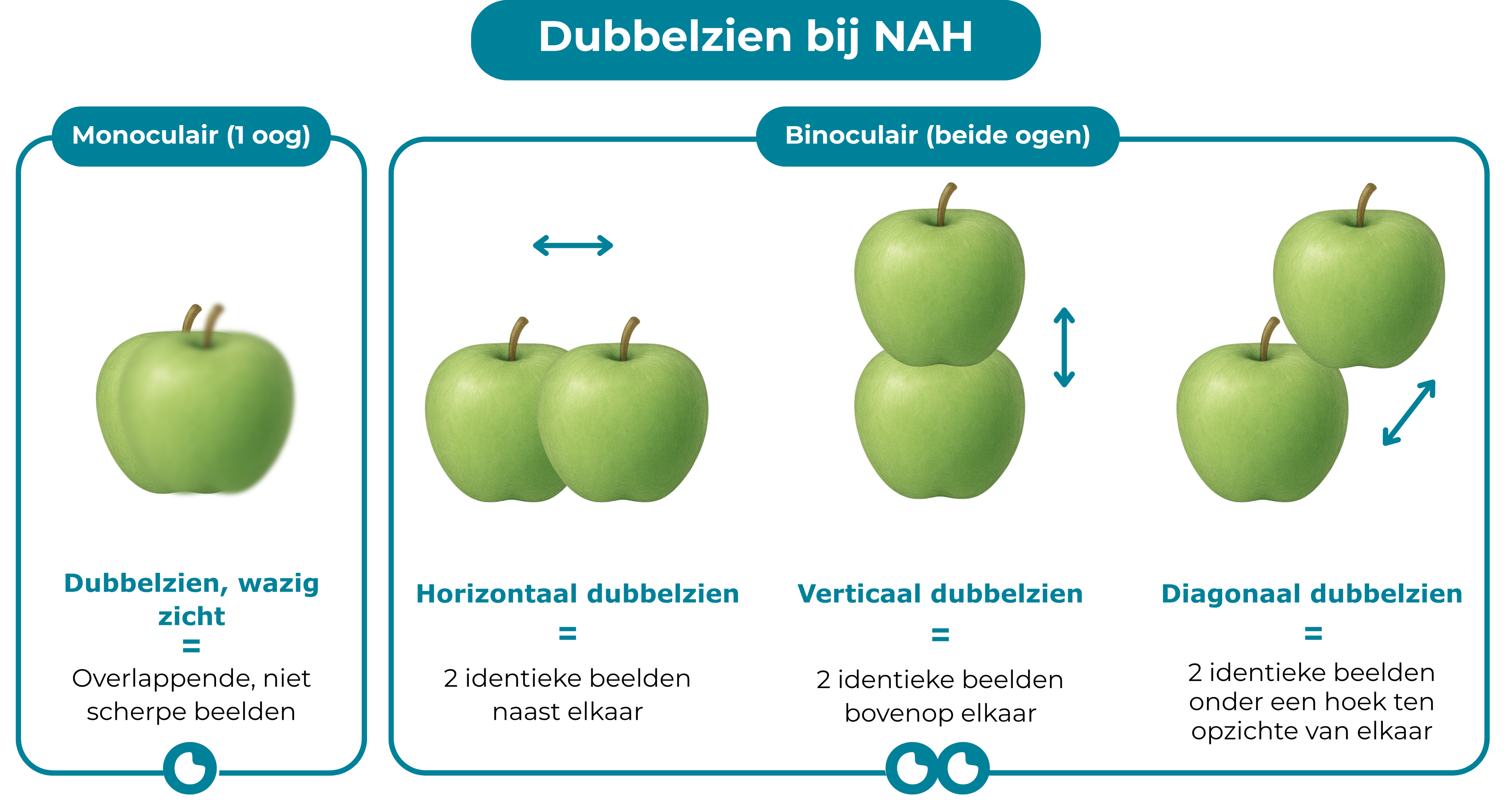 Titel: Dubbelzien bij NAH. Daaronder staan vier afbeeldingen van steeds twee appels. Bij de linker afbeelding staat ‘Monoculair (1 oog): hier zie je de twee appels vlak bij elkaar, de achterste is scherp, de appel ervoor onscherp. Hieronder staat: dubbelzien, wazig zicht = overlappende niet scherpe beelden. De drie andere setjes appels vallen onder de noemer ‘Binoculair (beide ogen)’. De appels in het eerste van deze drie setjes staan naast elkaar. Daaronder staat: Horizontaal dubbelzien = 2 identieke beeld