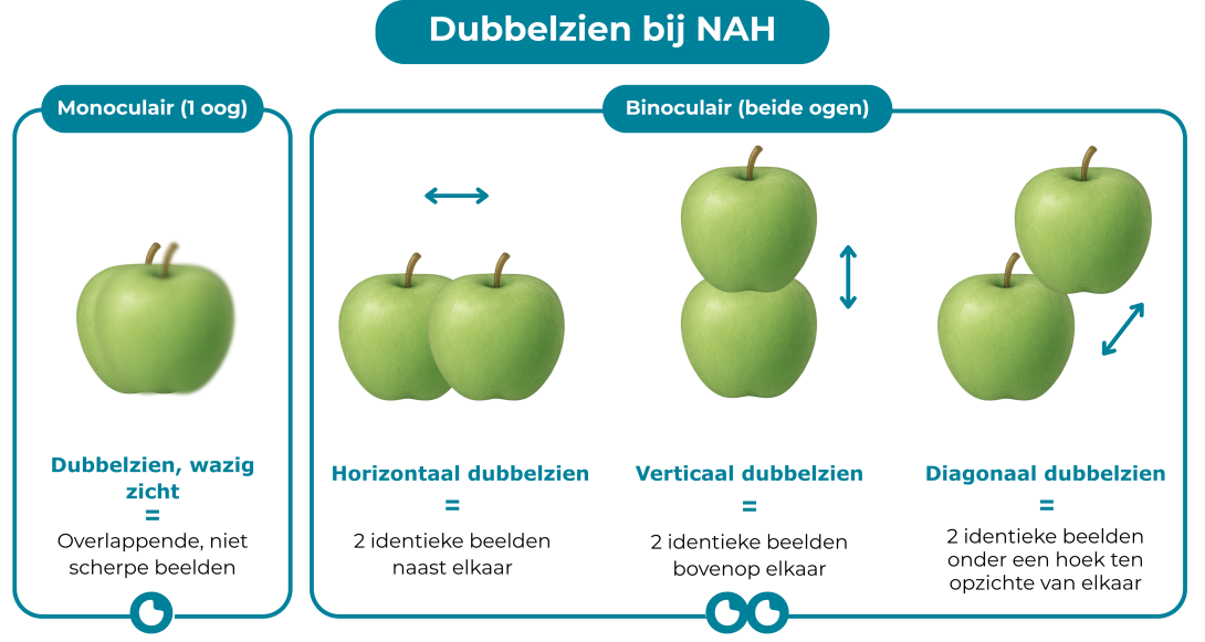 Titel: Dubbelzien bij NAH. Daaronder staan vier afbeeldingen van steeds twee appels. Bij de linker afbeelding staat ‘Monoculair (1 oog): hier zie je de twee appels vlak bij elkaar, de achterste is scherp, de appel ervoor onscherp. Hieronder staat: dubbelzien, wazig zicht = overlappende niet scherpe beelden. De drie andere setjes appels vallen onder de noemer ‘Binoculair (beide ogen)’. De appels in het eerste van deze drie setjes staan naast elkaar. Daaronder staat: Horizontaal dubbelzien = 2 identieke beeld
